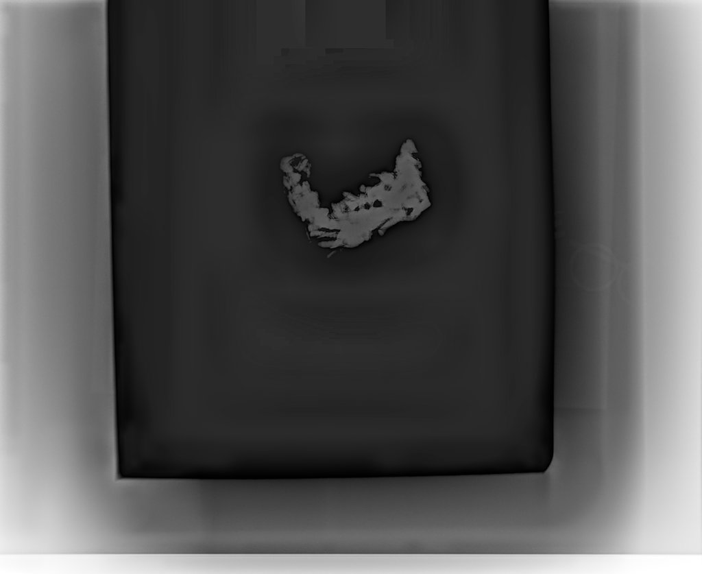 X-ray image of fused screws from Chicago Fire of 1871
