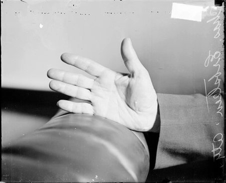 Right hand of attorney Charles A. Erbstein - Chicago Daily News, Inc.