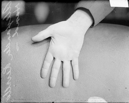 Palm of the right hand of Alexander H. Revell - Chicago Daily News, Inc.