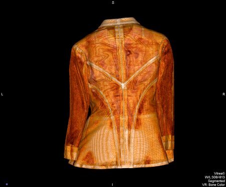 Computerized tomography (CT) scan of evening dress - James, Charles, 1906-1978